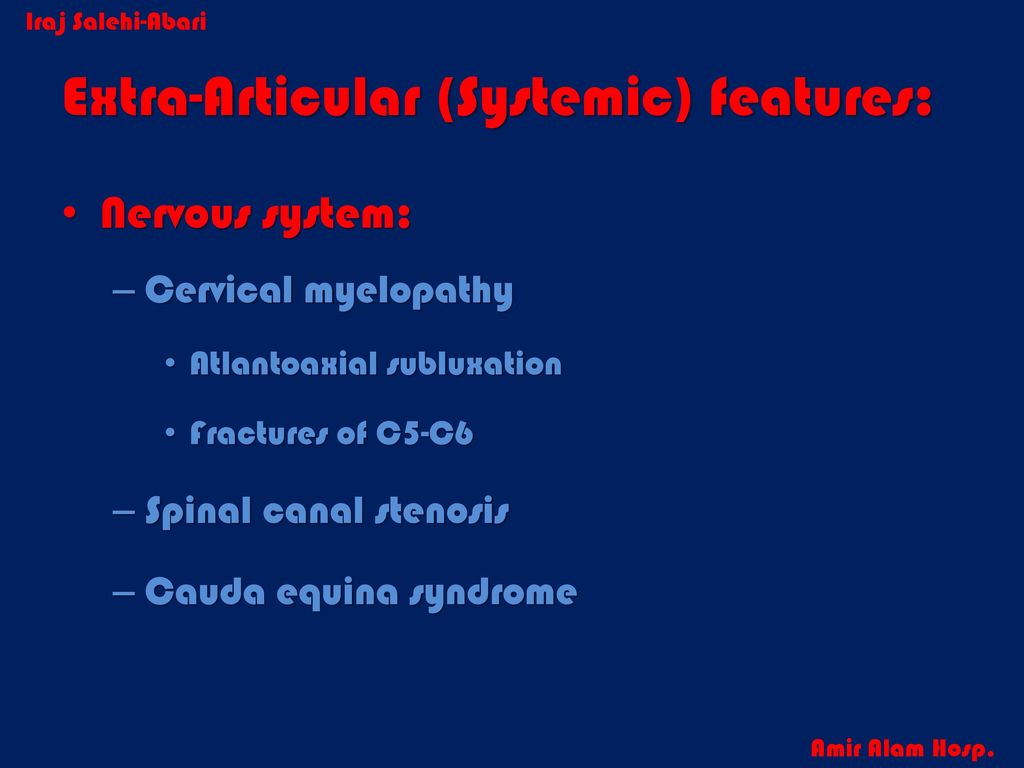 Approach To Diagnosis Of Ankylosing Spondylitis Iraj Salehi Abari Md